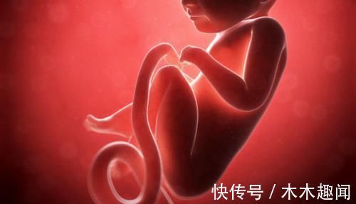 脐带|胎儿脐带绕颈有风险,孕妈少做以下三件事,做多了可能绕得多
