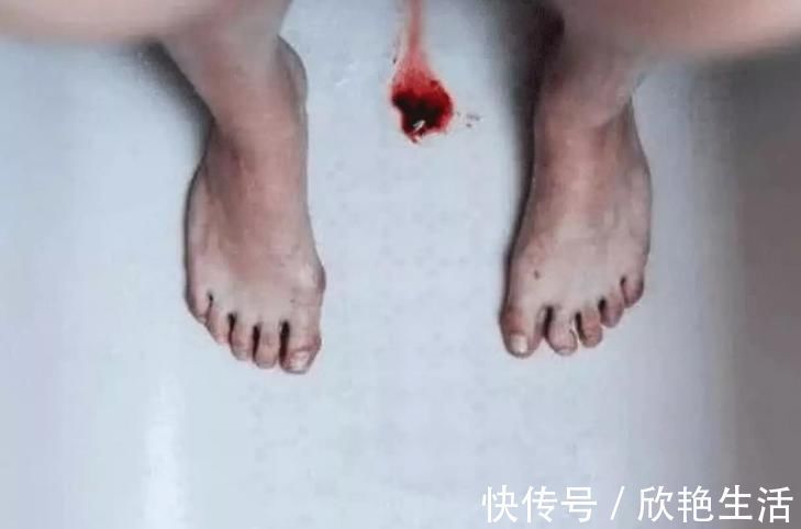 月经期|女生月经期,为什么会排出像“肉”一样的血块?女网友:影响怀孕吗?