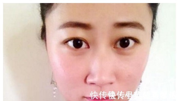 我们来了|割了双眼皮的人,老了之后会变成什么样子?可能很多人不知道吧?