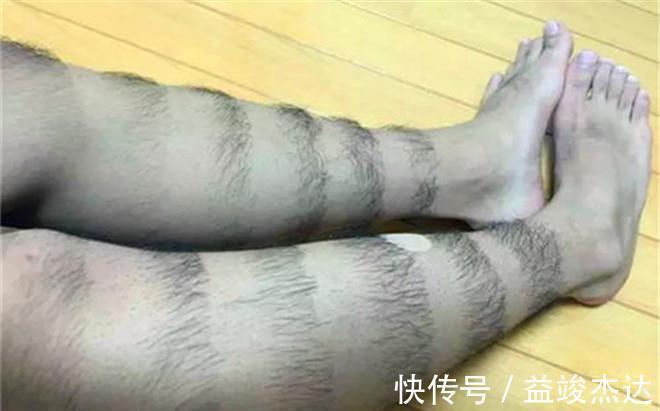 雄激素|生活冷知识,腿毛多和少,与健康有何差异?