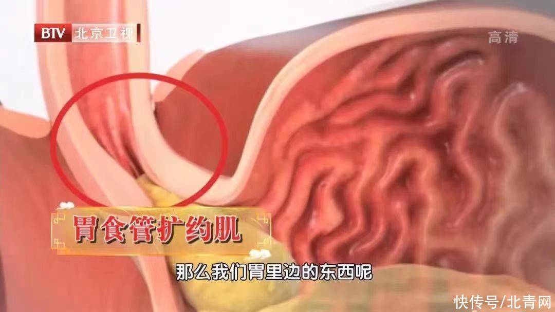 胃食管反流|胃病无小事，一不小心可能拖成癌！有这些迹象要及时就诊