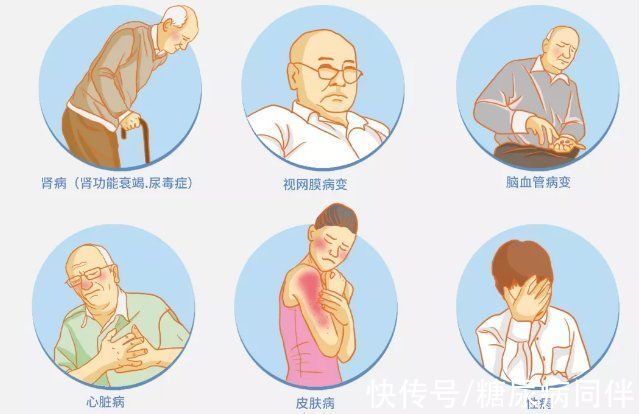 糖尿病患者|糖尿病肾病】糖尿病离尿毒症有多远？该怎样预防？