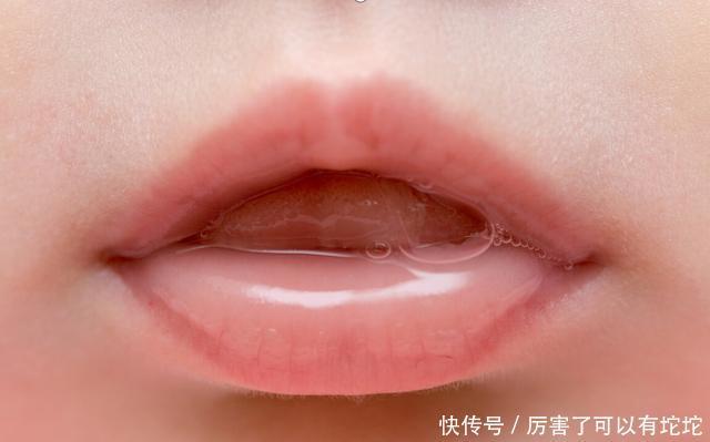 医生提醒:甘油三酯过高的人,这2种素食尽量少吃,以免升高血脂