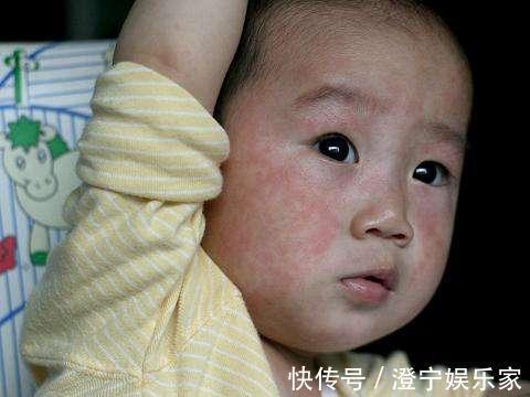 抗生素|宝宝出现9个特点,可能是患急疹了,教你5个方法,在家就能护理