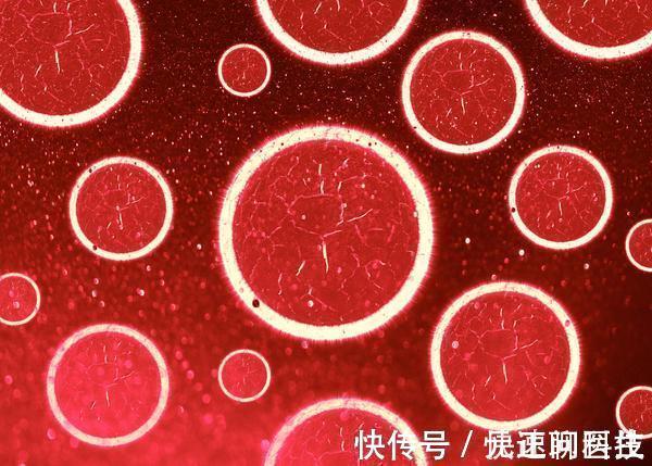 癌症|癌症不是做了手术就万事大吉，加强饮食营养，巩固治疗，不能不做