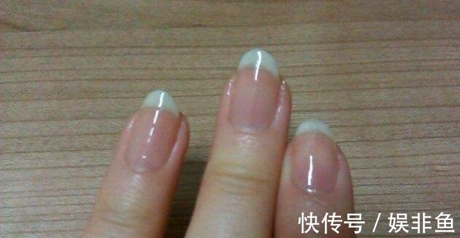 肝硬化|肝不好的女人,早起会有3种异常,肝硬化顺势而起,肝癌悄然而至