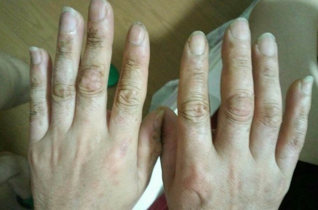 医生|消化科医生养胃很简单,3种“零食”,你若爱吃,胃自然好起来