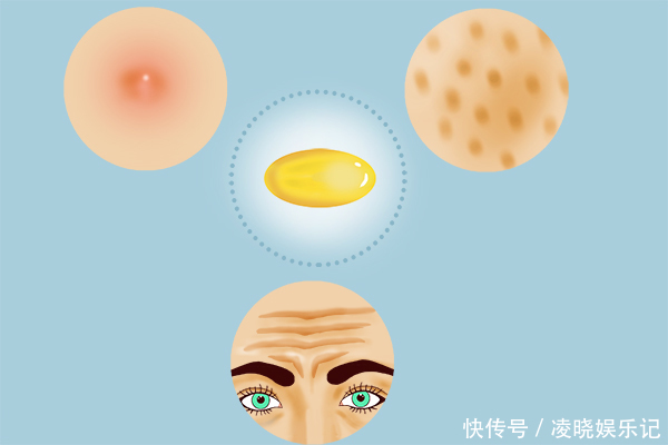 雌激素|维生素E内服好还是外用好?有什么区别?别用错了