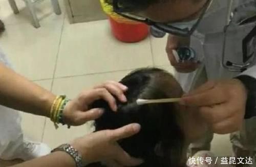孩子|爸爸给女儿梳头发现“小米粒”,送去就医后,检查结果让他后怕