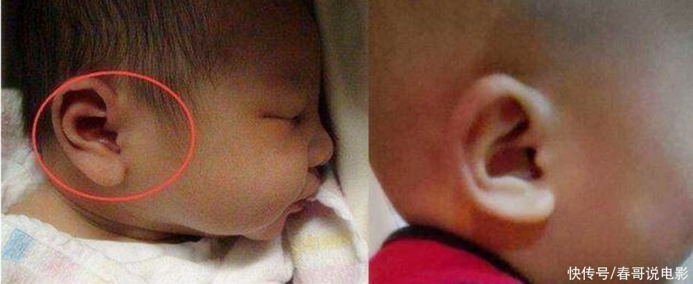 耳朵|宝宝的这个“部位”越大,越是“高智商”的表现,你家宝宝是吗?