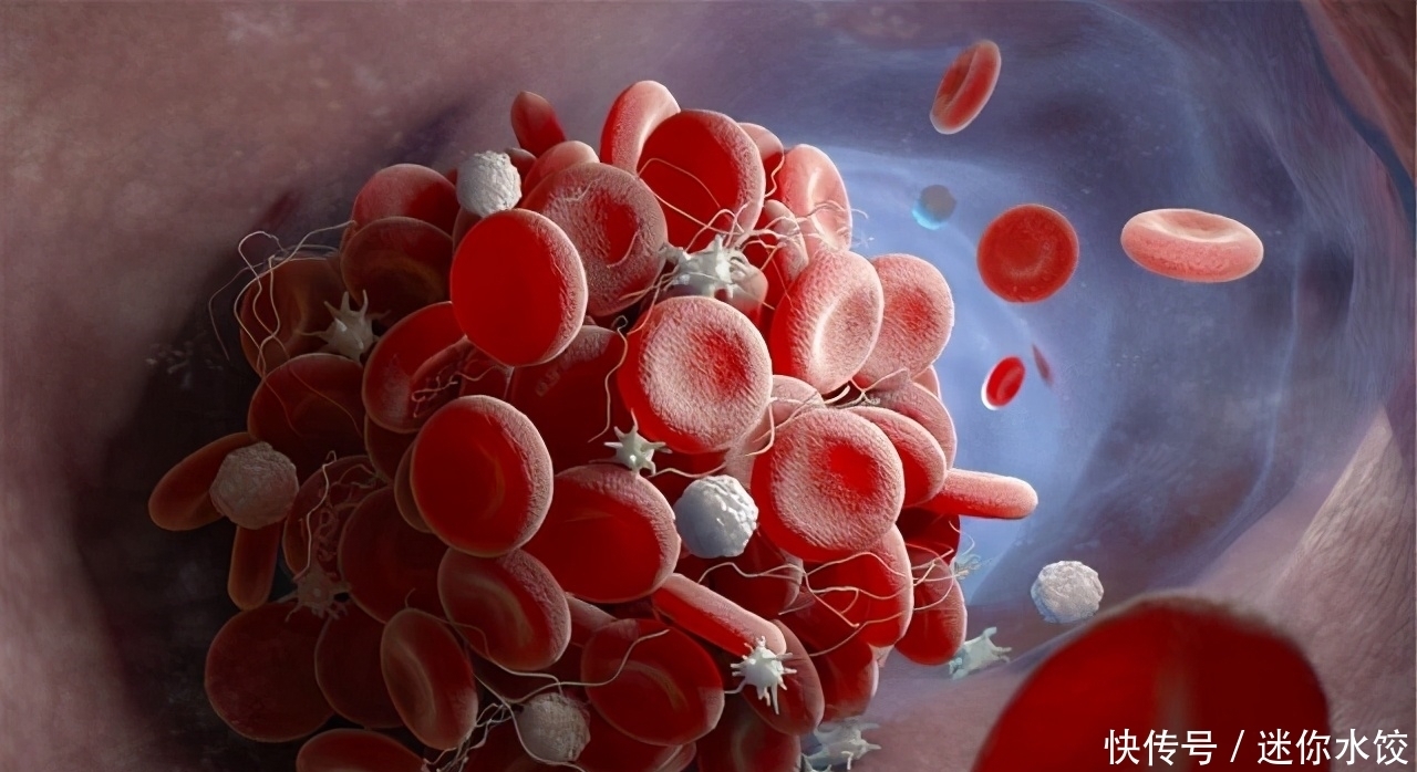 人到中年，睡觉时出现2个“迹象”，或与一件事有关：血液粘稠了