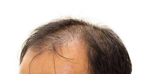 大肚腩|男人50岁后，身上若没有出现这4种表现，还不错，长寿或偏爱你