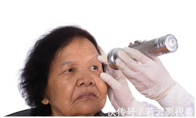 血脂异常|血脂高不高,看脸就知道,若没有这3个症状,恭喜血脂控制得不错