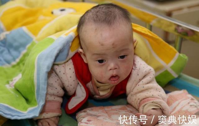 胎动|6个月婴儿紧握拳头,奶奶发现不对劲带去医院检查,医生来晚了