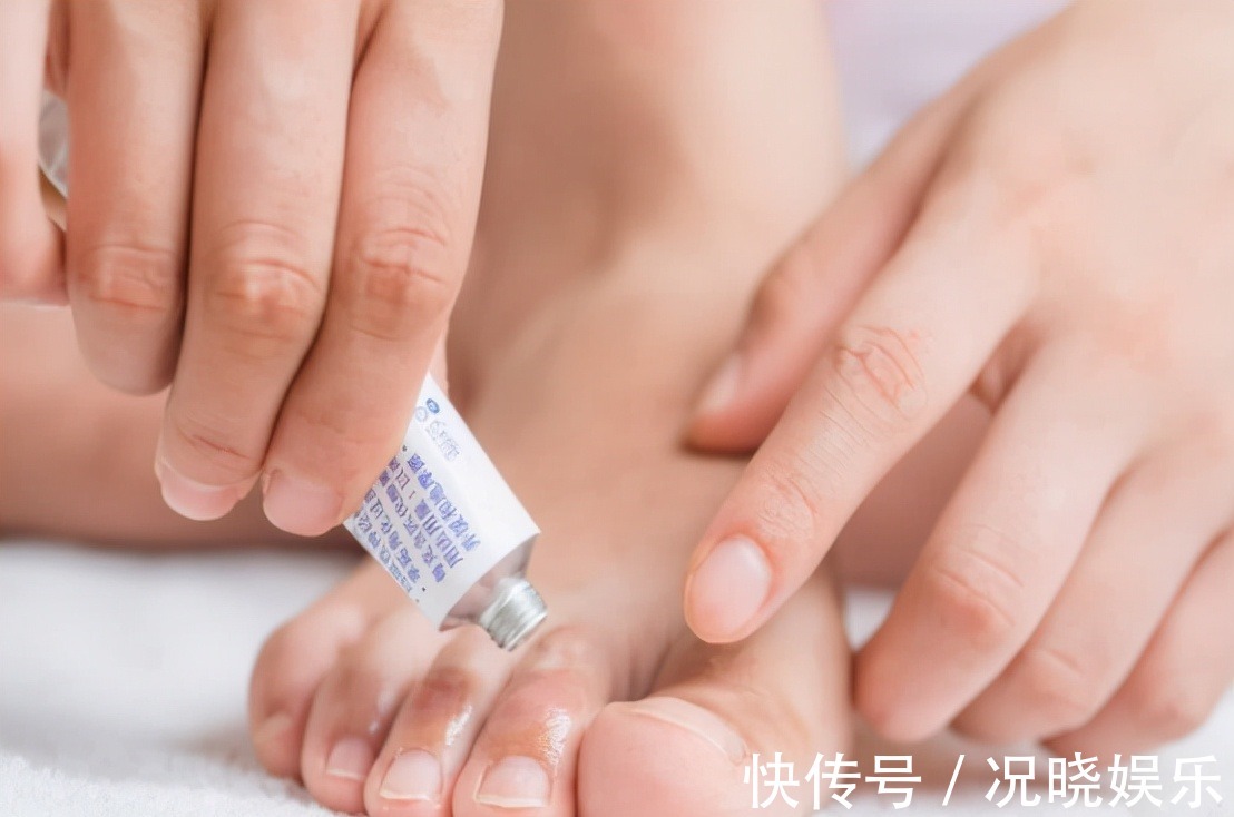 偏头痛|几块钱一瓶的维生素B2,却是高血压的克星,多数人都不知道