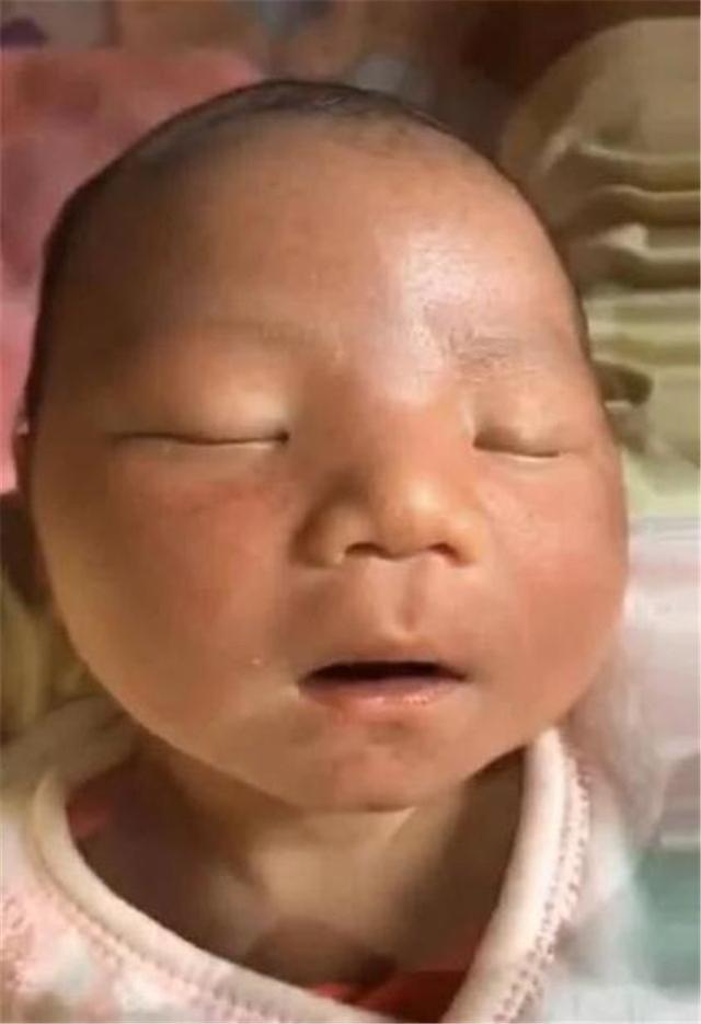 嫌弃|“黑脸宝宝”被全家人嫌弃,两个月后完美逆袭,宝妈:幸好没丢掉