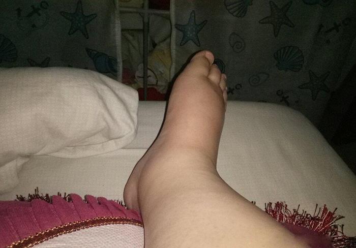 生双胞胎|“生剖”是什么体验?抗麻体质剖腹产生双胞胎,痛得直哆嗦