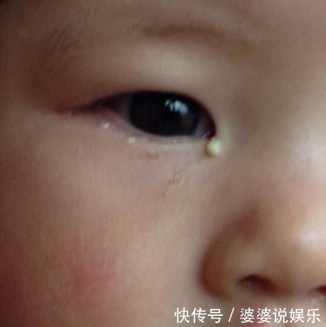 白萝卜汤|中医教你：小孩积食不要慌，3招轻松解决“小儿积食”、调好脾胃