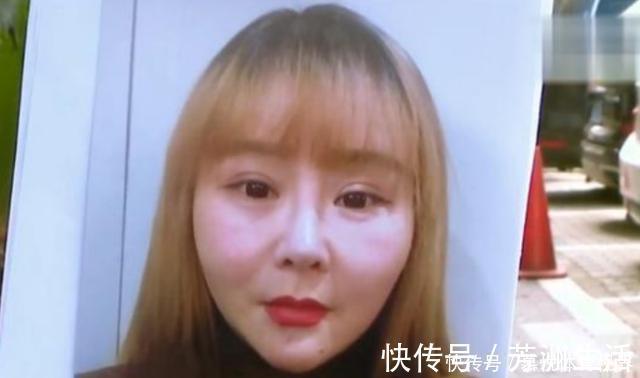 赵经理 花了13000元做脸部埋线，术后美颜相机都救不了？姑娘：脸更胖了