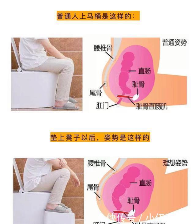 宝宝|孕后期如厕不易怎么办?用上它不仅舒服,还对宝宝有益处