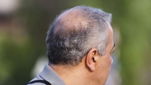 中老年人|男性衰老的五大标志,若出现一个,那也说明老了别不好意思承认