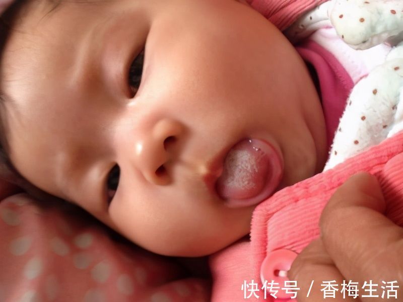 家长|孩子积食是拖出来的,脸上发现3种迹象,脾胃已经不堪负重了