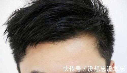 身体|身体好不好，从头发能看出来？白发生长位置不同，暗示不同疾病？