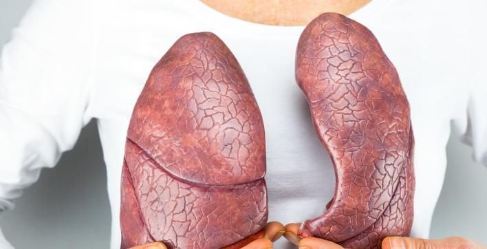 鳞状细胞|4个关于肺癌的真相，听完你可能会感到意外，一起来了解一下