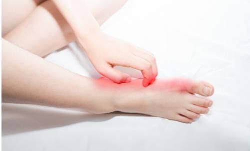 传染|脚气痒、痒、痒!中医师:都是湿热惹的祸,简单一味药,帮你解决