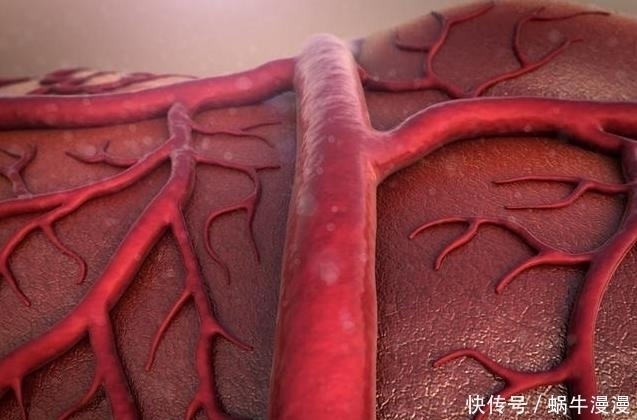 食物|颈动脉一通,脑梗无踪影,学会吃2类食物,早疏通,早预防