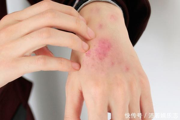 女性常年佩戴银手镯,三个变化令人羡慕不已,但有一类人慎戴