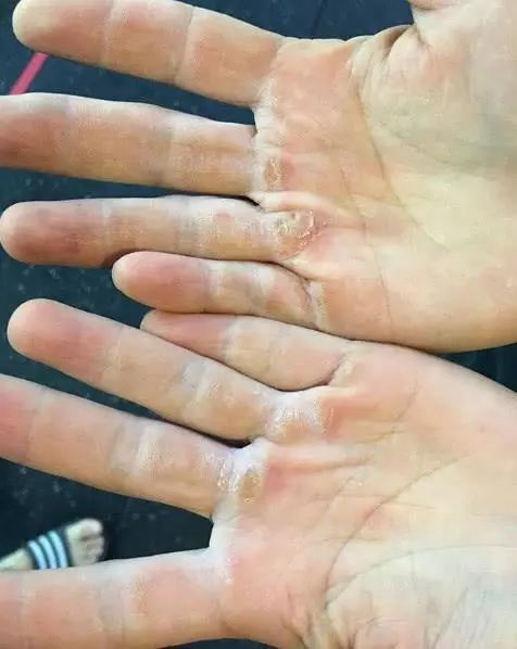 体脂率|辣妈健身太疯狂,双手撸出老茧,臀部硬如铁块!