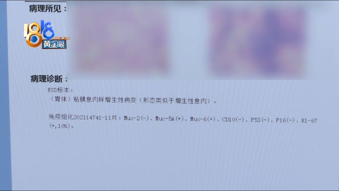 泡椒猪皮|12岁孩子胃部长“肿瘤”，可能跟吃了两年辣条泡面有关