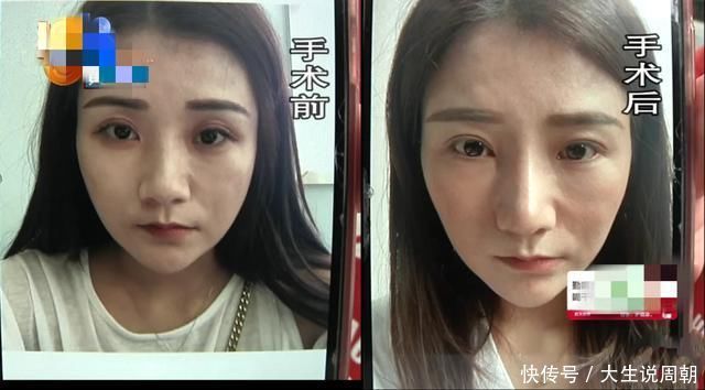 经过整容女子竟老了十岁，整形院老板就是这个效果