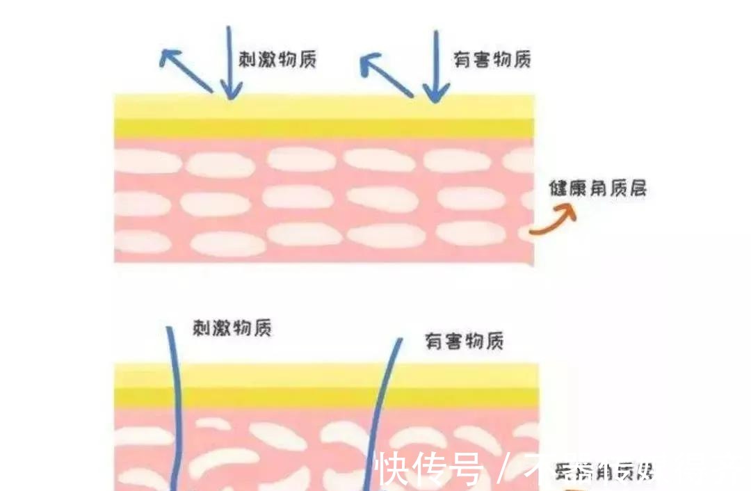 护肤|秋季适合做哪些医美护肤项目