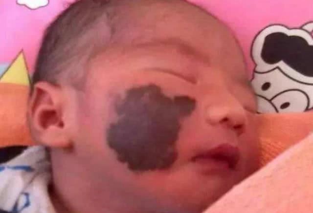 胎记|怀孕时,孕妇最好别做这4事,当心宝宝身上会留“胎记”,再喜欢也要忍住