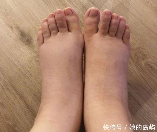 脚后跟|肾好不好要看脚,脚上若没有出现这3种情况,说明你的肾很健康!