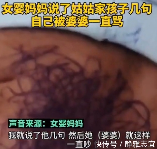 姑姑|满月女婴遭亲戚孩子乱涂乱画，脸上全是墨水，亲戚：和孩子较啥劲