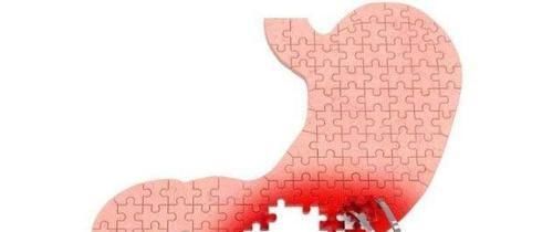 幽门螺杆菌要不要根除？答案让你有些无奈！医生：并没有那么糟糕