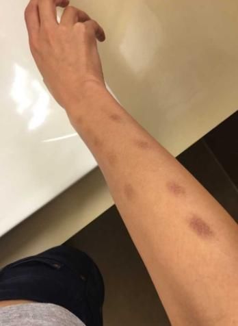 体毛|女性这3处毛发旺盛,是好还是不好?可能跟你想得不一样