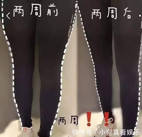 女生|建议“腿粗”女生,分清肌肉腿和水肿腿再坚持这样做,想不瘦都难