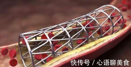 心血管药|西洋参大补补出事医生紧急提醒这些心血管药不能与中药同服