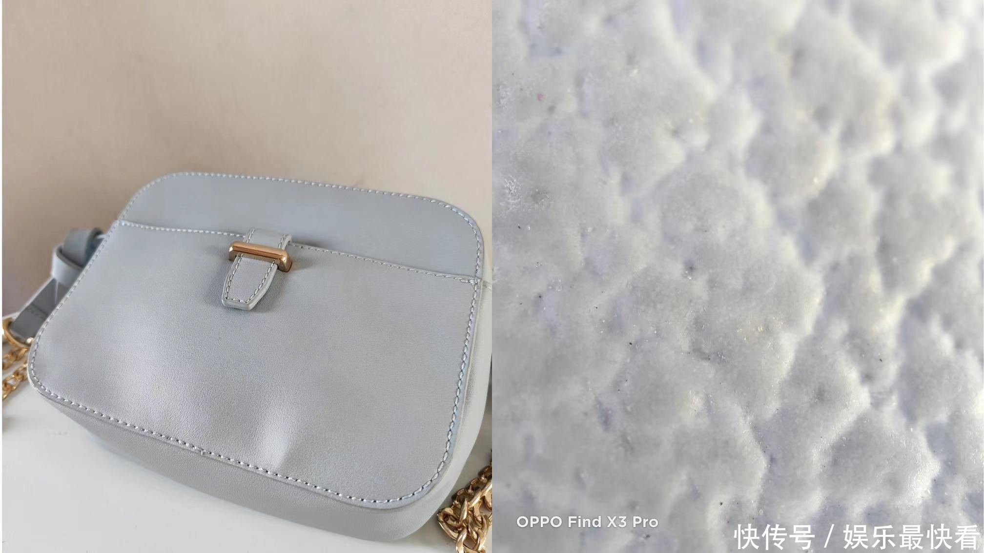 最近流行显微镜皮肤缺水测试？比美容院仪器还好使！直观又省钱