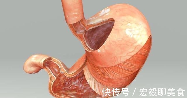 上皮细胞|幽门螺杆菌,中国人胃癌首害!医生提醒:积极预防,要做到这6点