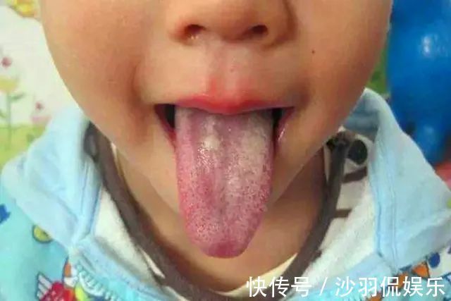 积食|孩子积食的信号你知道几个家长早知道好心里有底,遇上时不慌乱