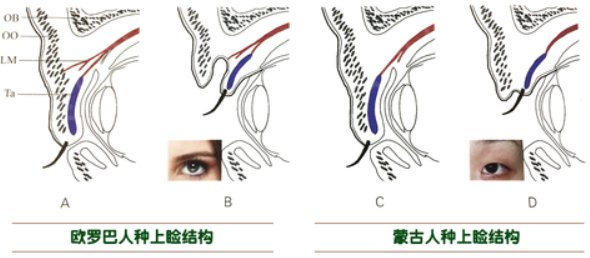 手术|「济南韩氏郭广科」教你选择适合自己的双眼皮手术