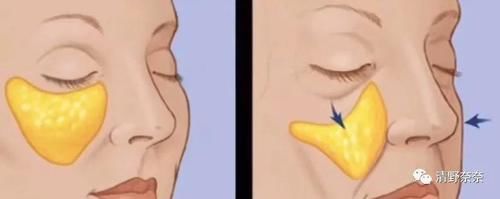 这些变化代表你老了!韩国女生最怕的5个老化现象