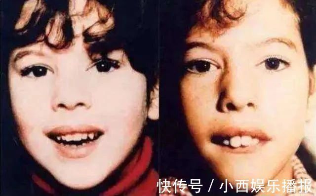 孩子|这5种孩子小时候好看也没用,只会越长越丑,你家孩子有中招吗?