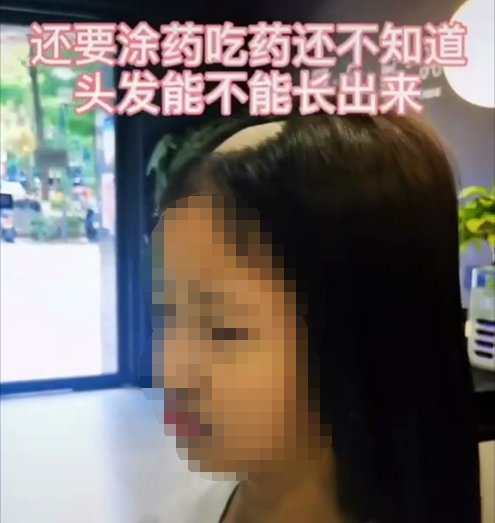回家|带回家才几天,女儿头顶“秃”了!妈妈崩溃:我悔啊...