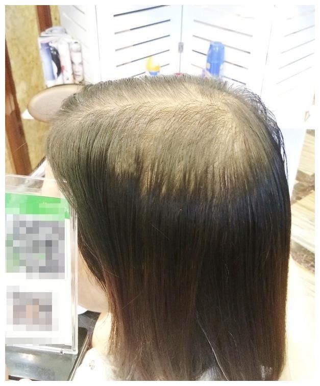 适合40岁遮白发的假发的清洗方法？